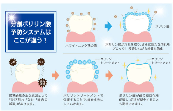 ここが違う