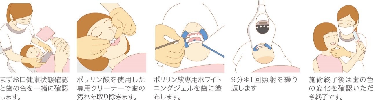 手順